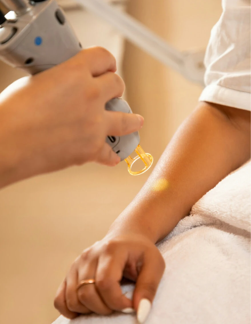 Skin Tag Removal